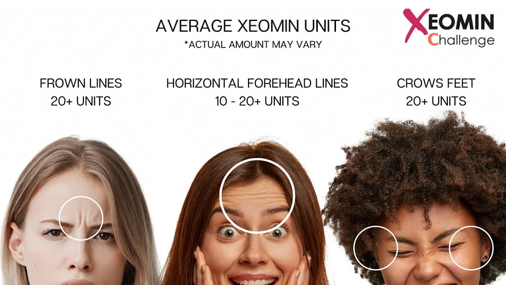 average xeomin units