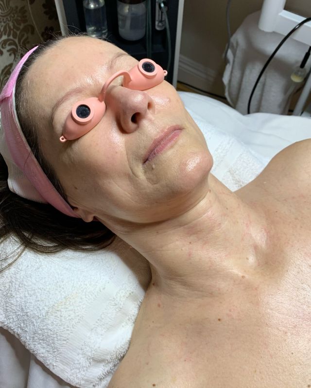 Home - Orange County Microblading, Facials, Lash Extensions 245 My client turning 50 soon 🥳NO BOTOX , NO FILLERSNo Filter ✨just Healthy, Glowy skin.Treatment: DMK Enzyme Therapy#facial #dmkenzyme #dmkenzymetherapy #skincare #facial #esthetician #beautyoc #oc #orangecounty #lagunaniguel #danapoint #lagunabeach